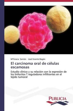 El Carcinoma Oral de Celulas Escamosas: La Arquitectura Mas Alla de Si Misma de María Gracia Sarrión