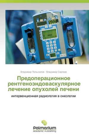 Predoperatsionnoe Rentgenoendovaskulyarnoe Lechenie Opukholey Pecheni: Identita E Specificita de Vladimir Polysalov