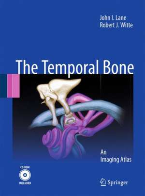 Temporal Bone: An Imaging Atlas de John I. Lane