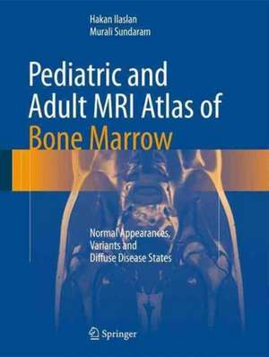 Pediatric and Adult MRI Atlas of Bone Marrow: Normal Appearances, Variants and Diffuse Disease States de Hakan Ilaslan