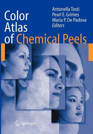 Color Atlas of Chemical Peels de Antonella Tosti