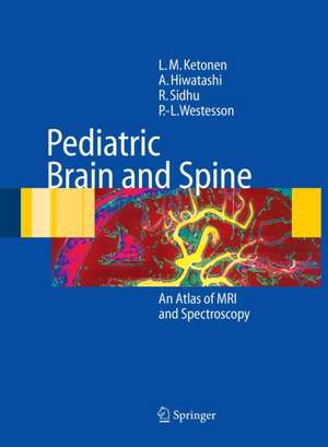 Pediatric Brain and Spine: An Atlas of MRI and Spectroscopy de L.M. Ketonen