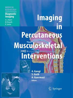 Imaging in Percutaneous Musculoskeletal Interventions de Afshin Gangi