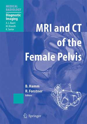 MRI and CT of the Female Pelvis de Bernd Hamm