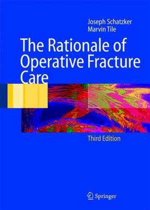 The Rationale of Operative Fracture Care de Joseph Schatzker