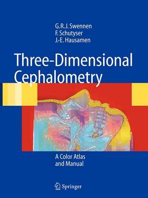 Three-Dimensional Cephalometry: A Color Atlas and Manual de Gwen R.J. Swennen