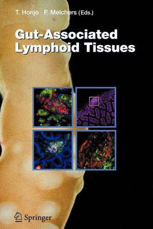 Gut-Associated Lymphoid Tissues de Tasuku Honjo