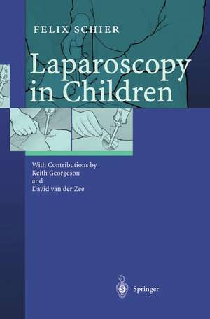 Laparoscopy in Children de Felix Schier