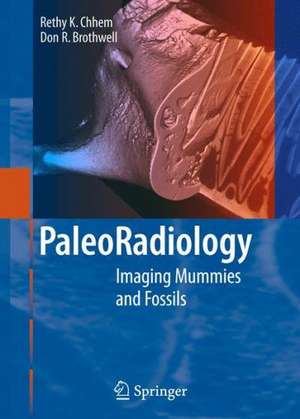 Paleoradiology: Imaging Mummies and Fossils de R.K. Chhem