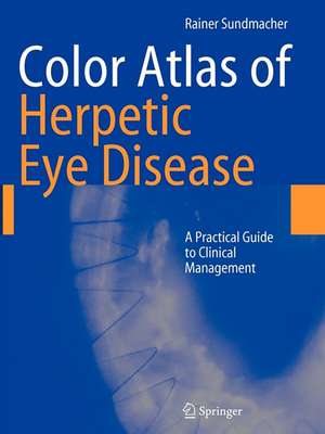 Color Atlas of Herpetic Eye Disease: A Practical Guide to Clinical Management de Rainer Sundmacher