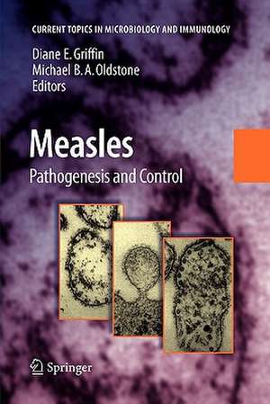 Measles: History and Basic Biology de Diane E. Griffin
