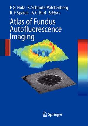 Atlas of Fundus Autofluorescence Imaging de Frank G. Holz