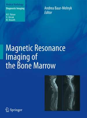 Magnetic Resonance Imaging of the Bone Marrow de Andrea Baur-Melnyk