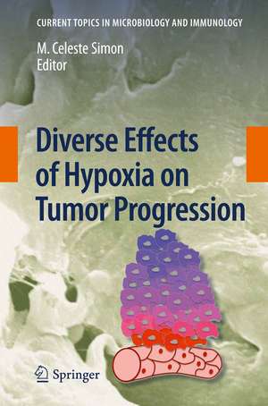 Diverse Effects of Hypoxia on Tumor Progression de M. Celeste Simon