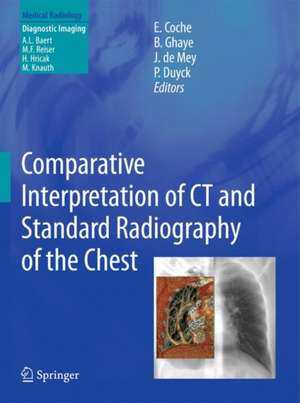 Comparative Interpretation of CT and Standard Radiography of the Chest de Emmanuel E. Coche