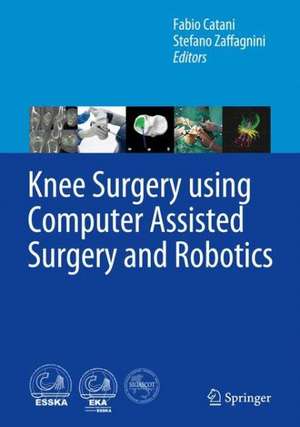 Knee Surgery using Computer Assisted Surgery and Robotics de Fabio Catani