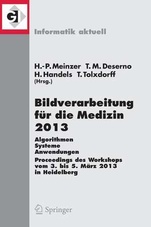 Bildverarbeitung für die Medizin 2013: Algorithmen - Systeme - Anwendungen. Proceedings des Workshops vom 3. bis 5. März 2013 in Heidelberg de Hans-Peter Meinzer