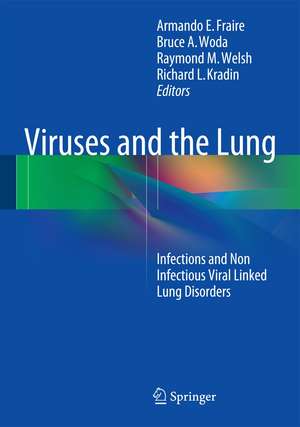 Viruses and the Lung: Infections and Non-Infectious Viral-Linked Lung Disorders de Armando E. Fraire