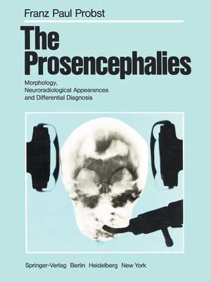 The Prosencephalies: Morphology, Neuroradiological Appearances and Differential Diagnosis de A. Brun