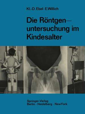 Die Röntgenuntersuchung im Kindesalter: Technik und Indikation de Klaus-Dietrich Ebel