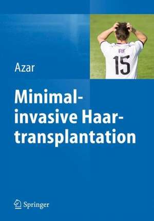 Minimalinvasive Haartransplantation de Reza P. Azar