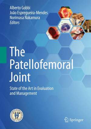 The Patellofemoral Joint: State of the Art in Evaluation and Management de Alberto Gobbi