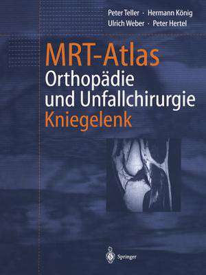 MRT-Atlas Orthopädie und Unfallchirurgie: Kniegelenk de Peter Teller