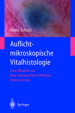 Auflichtmikroskopische Vitalhistologie: Dermatologischer Leitfaden de Hans Schulz