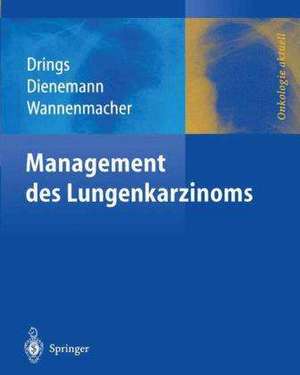 Management des Lungenkarzinoms de Peter Drings