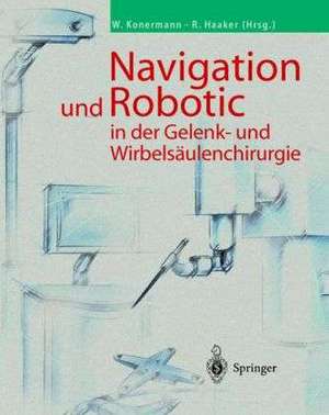 Navigation und Robotic in der Gelenk- und Wirbelsäulenchirurgie de Werner Konermann