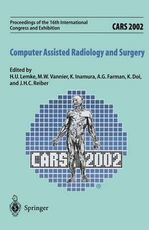 CARS 2002 Computer Assisted Radiology and Surgery: Proceedings of the 16th International Congress and Exhibition Paris, June 26–29,2002 de H.U. Lemke