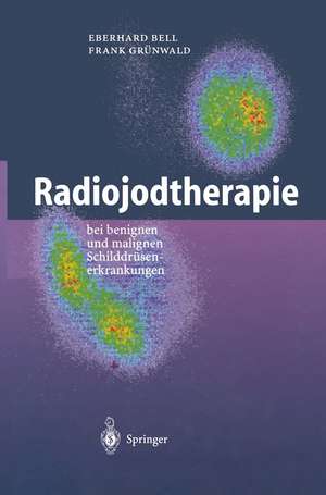 Radiojodtherapie: bei benignen und malignen Schilddrüsenerkrankungen de Eberhard Bell