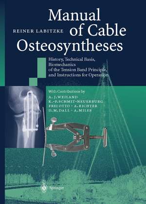 Manual of Cable Osteosyntheses: History, Technical Basis, Biomechanics of the Tension Band Principle, and Instructions for Operation de Reiner Labitzke