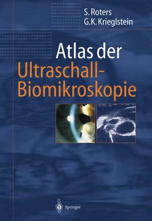 Atlas der Ultraschall-Biomikroskopie de Sigrid Roters