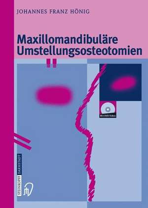 Maxillomandibuläre Umstellungsosteotomien de Johannes-Franz Hönig