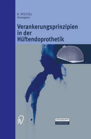 Verankerungsprinzipien in der Hüftendoprothetik de Roland Wetzel