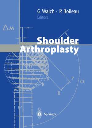 Shoulder Arthroplasty de N. Gschwend