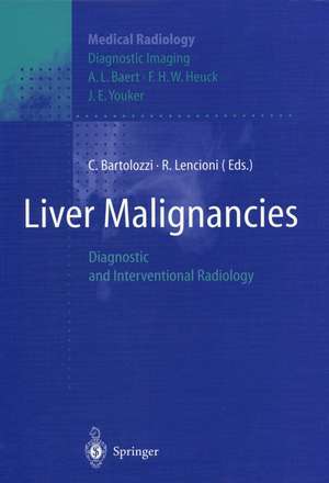 Liver Malignancies: Diagnostic and Interventional Radiology de C. Bartolozzi