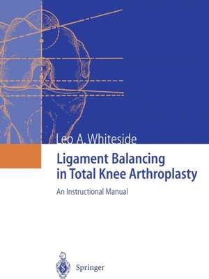 Ligament Balancing in Total Knee Arthroplasty: An Instructional Manual de Leo A. Whiteside