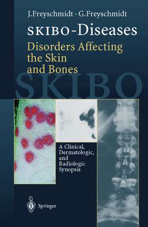 SKIBO-Diseases Disorders Affecting the Skin and Bones: A Clinical, Dermatologic, and Radiologic Synopsis de Jürgen Freyschmidt