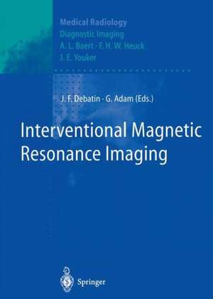 Interventional Magnetic Resonance Imaging de Jörg F. Debatin