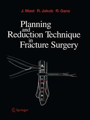 Planning and Reduction Technique in Fracture Surgery de H. Willenegger