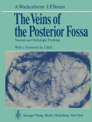 The Veins of the Posterior Fossa: Normal and Pathologic Findings de A. Wackenheim