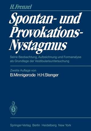 Spontan- und Provokations-Nystagmus: Seine Beobachtung, Aufzeichnung und Formanalyse als Grundlage der Vestibularisuntersuchung de Hermann Frenzel