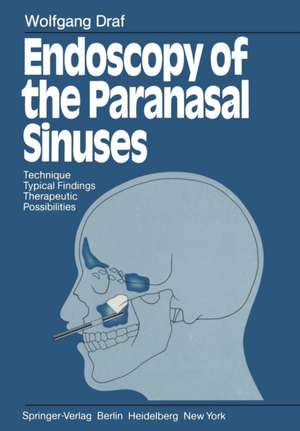 Endoscopy of the Paranasal Sinuses: Technique · Typical Findings Therapeutic Possibilities de Wolfgang Draf