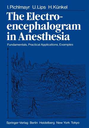 The Electroencephalogram in Anesthesia: Fundamentals, Practical Applications, Examples de I. Pichlmayr