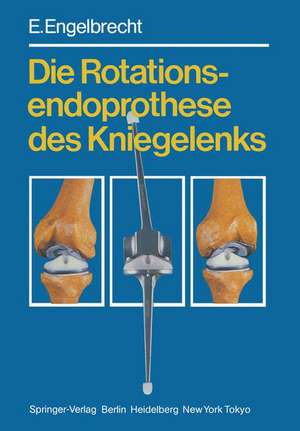 Die Rotationsendoprothese des Kniegelenks de H. W. Buchholz