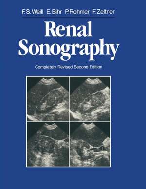 Renal Sonography de Francis S. Weill