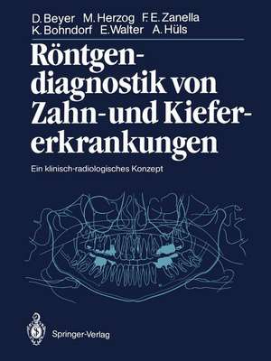 Röntgendiagnostik von Zahn- und Kiefererkrankungen: Ein klinisch-radiologisches Konzept de Dieter Beyer