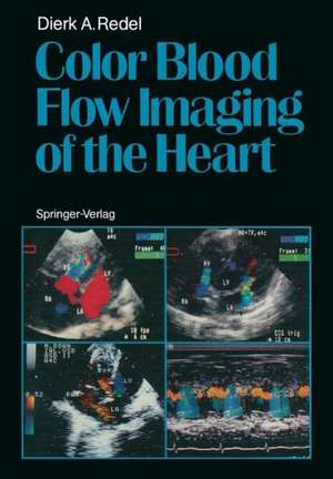 Color Blood Flow Imaging of the Heart de Dierk A. Redel